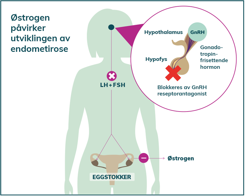MoA kvinna_norsk